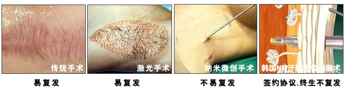手术效果对比.jpg
