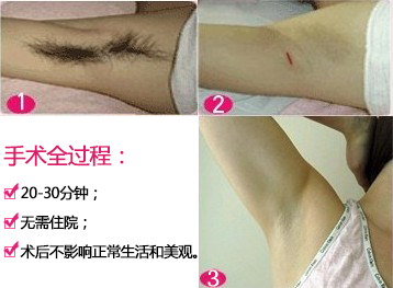手术 过程.jpg